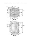 GASTRIC BAND DEVICES AND DRIVE SYSTEMS diagram and image