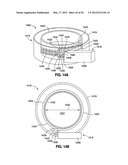 GASTRIC BAND DEVICES AND DRIVE SYSTEMS diagram and image