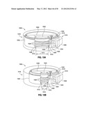 GASTRIC BAND DEVICES AND DRIVE SYSTEMS diagram and image