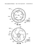 GASTRIC BAND DEVICES AND DRIVE SYSTEMS diagram and image