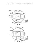 GASTRIC BAND DEVICES AND DRIVE SYSTEMS diagram and image