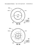 GASTRIC BAND DEVICES AND DRIVE SYSTEMS diagram and image