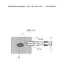 TREATMENT TOOL FOR ENDOSCOPE diagram and image