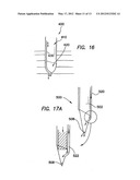 INSUFFLATING OPTICAL SURGICAL INSTRUMENT diagram and image