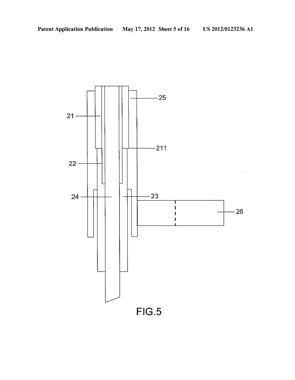 APPARATUS AND METHOD FOR BRAIN FIBER BUNDLE MICROSCOPY - diagram, schematic, and image 06