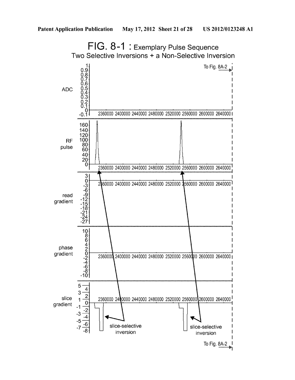 DARK BLOOD DELAYED ENHANCEMENT MAGNETIC RESONANCE VIABILITY IMAGING     TECHNIQUES FOR ASSESSING SUBENDOCARDIAL INFARCTS - diagram, schematic, and image 22