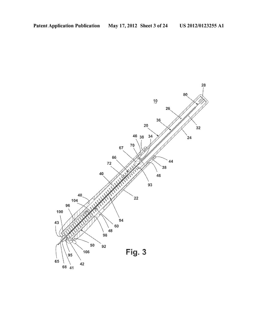 APPARATUS FOR IMPLANTING A PRELOADED LOCALIZATION WIRE - diagram, schematic, and image 04