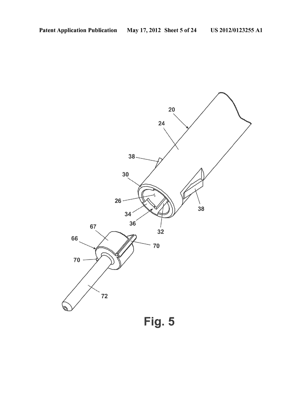 APPARATUS FOR IMPLANTING A PRELOADED LOCALIZATION WIRE - diagram, schematic, and image 06