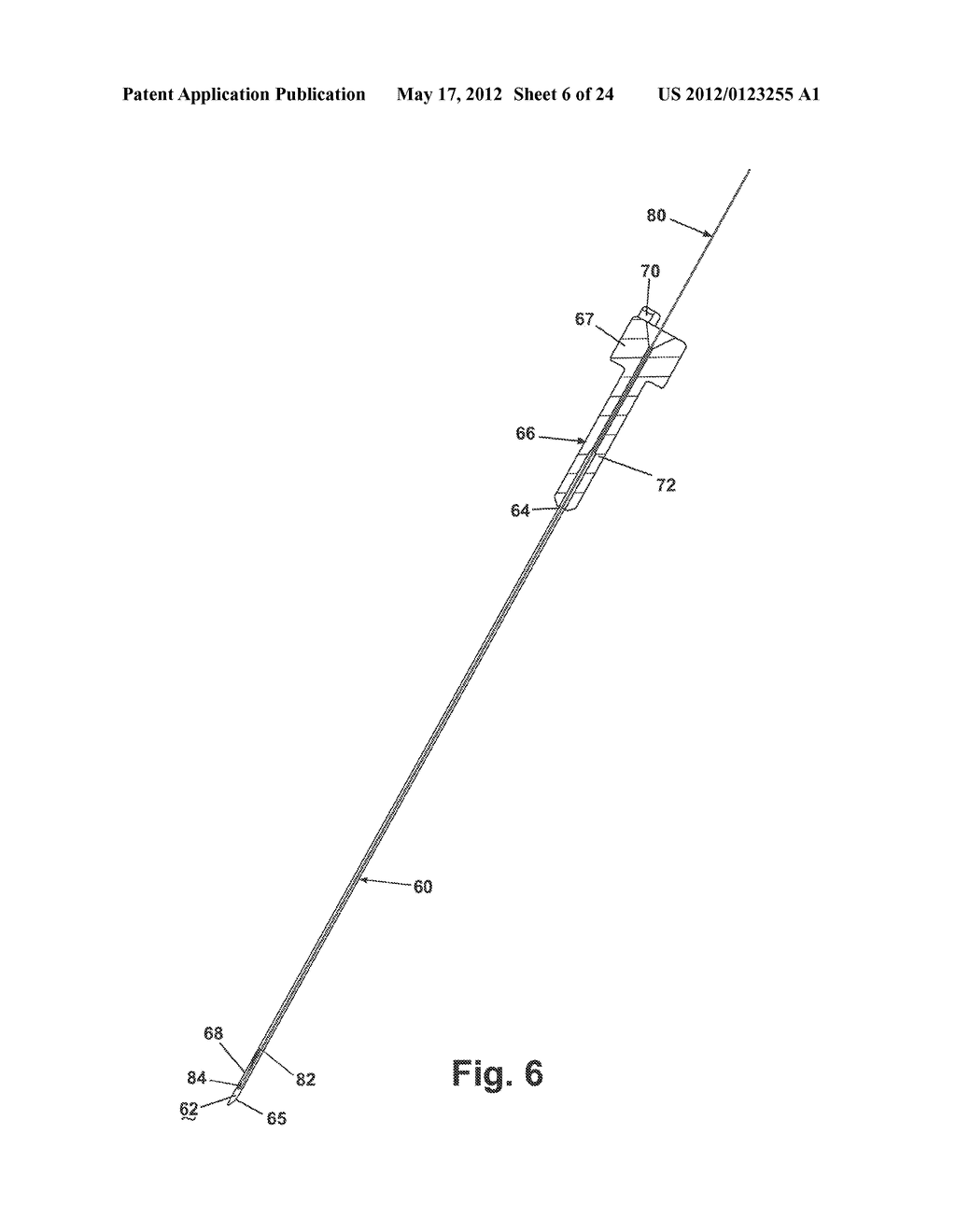 APPARATUS FOR IMPLANTING A PRELOADED LOCALIZATION WIRE - diagram, schematic, and image 07