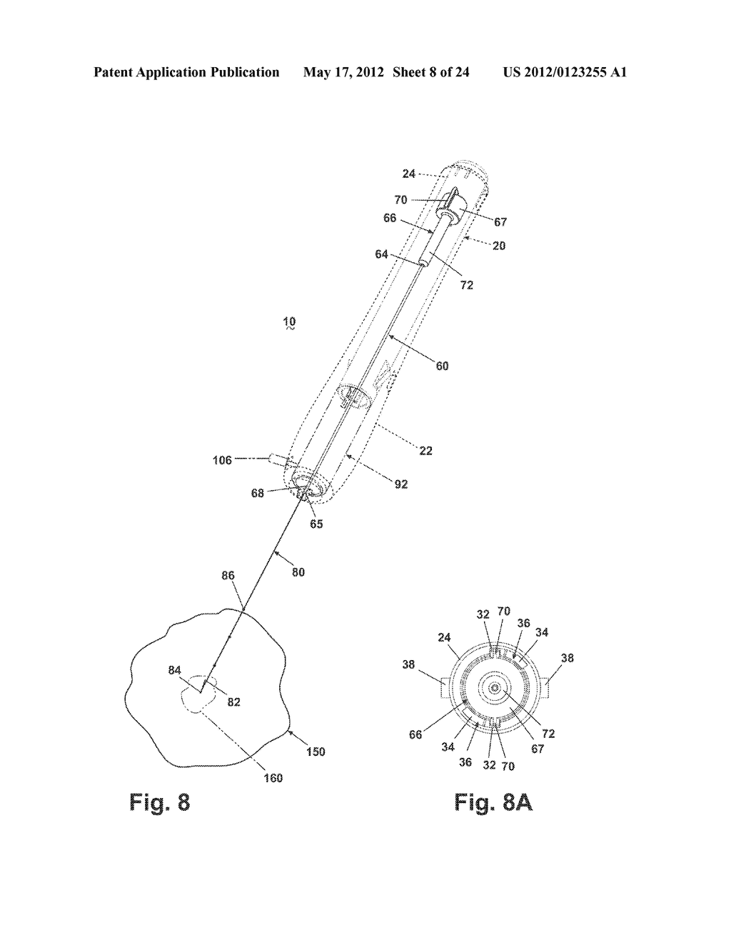 APPARATUS FOR IMPLANTING A PRELOADED LOCALIZATION WIRE - diagram, schematic, and image 09