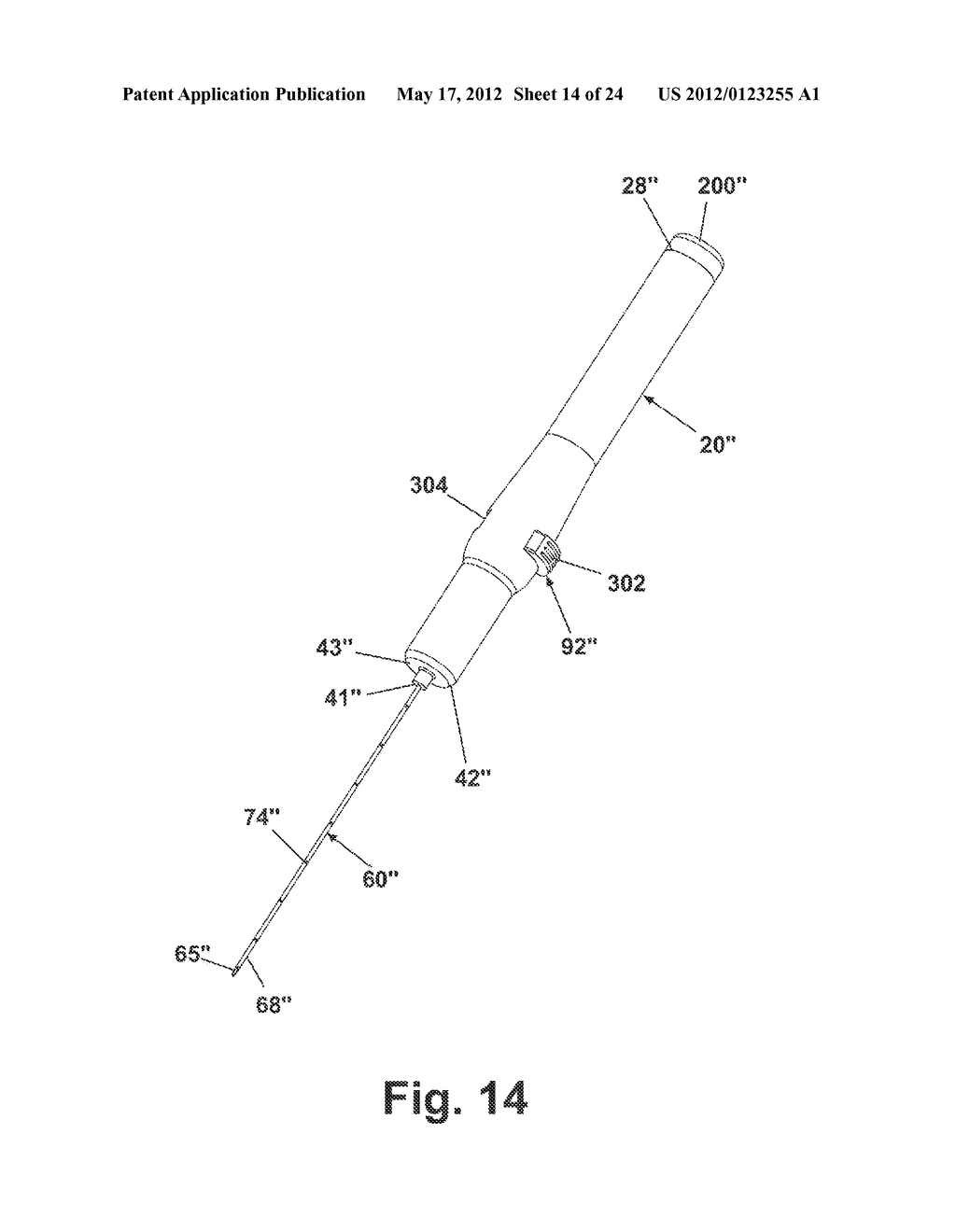 APPARATUS FOR IMPLANTING A PRELOADED LOCALIZATION WIRE - diagram, schematic, and image 15