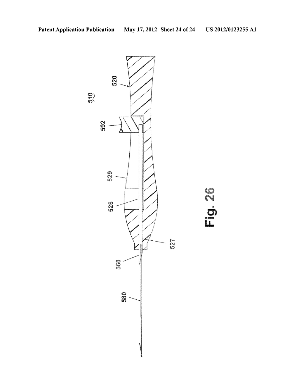 APPARATUS FOR IMPLANTING A PRELOADED LOCALIZATION WIRE - diagram, schematic, and image 25