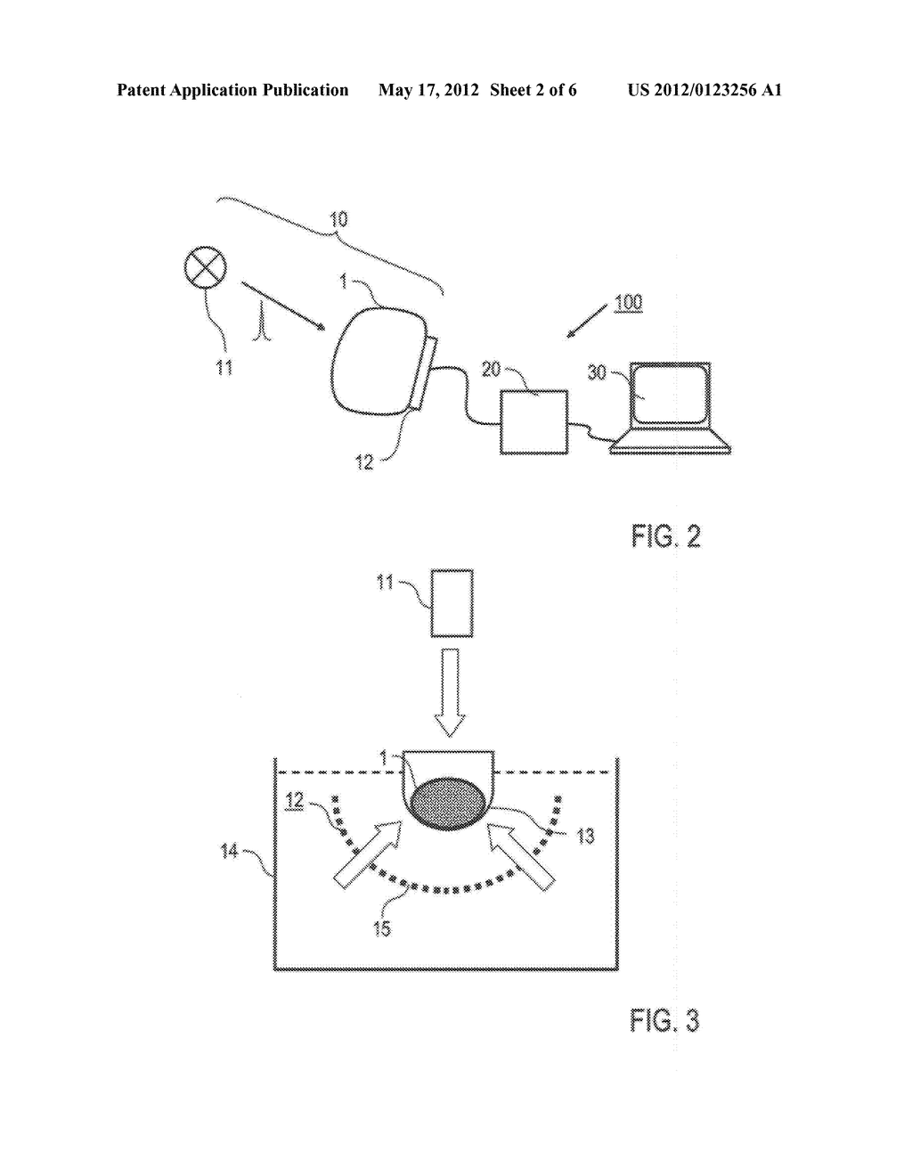 THERMOACOUSTIC IMAGING WITH QUANTITATIVE EXTRACTION OF ABSORPTION MAP - diagram, schematic, and image 03