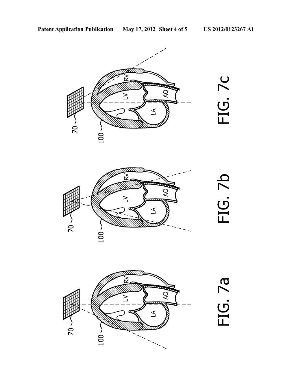 THREE DIMENSIONAL FETAL HEART IMAGING BY NON-ECG PHYSIOLOGICAL GATED     ACQUISITION - diagram, schematic, and image 05