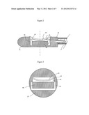 ROTARY ULTRASOUND IMAGING SYSTEM diagram and image