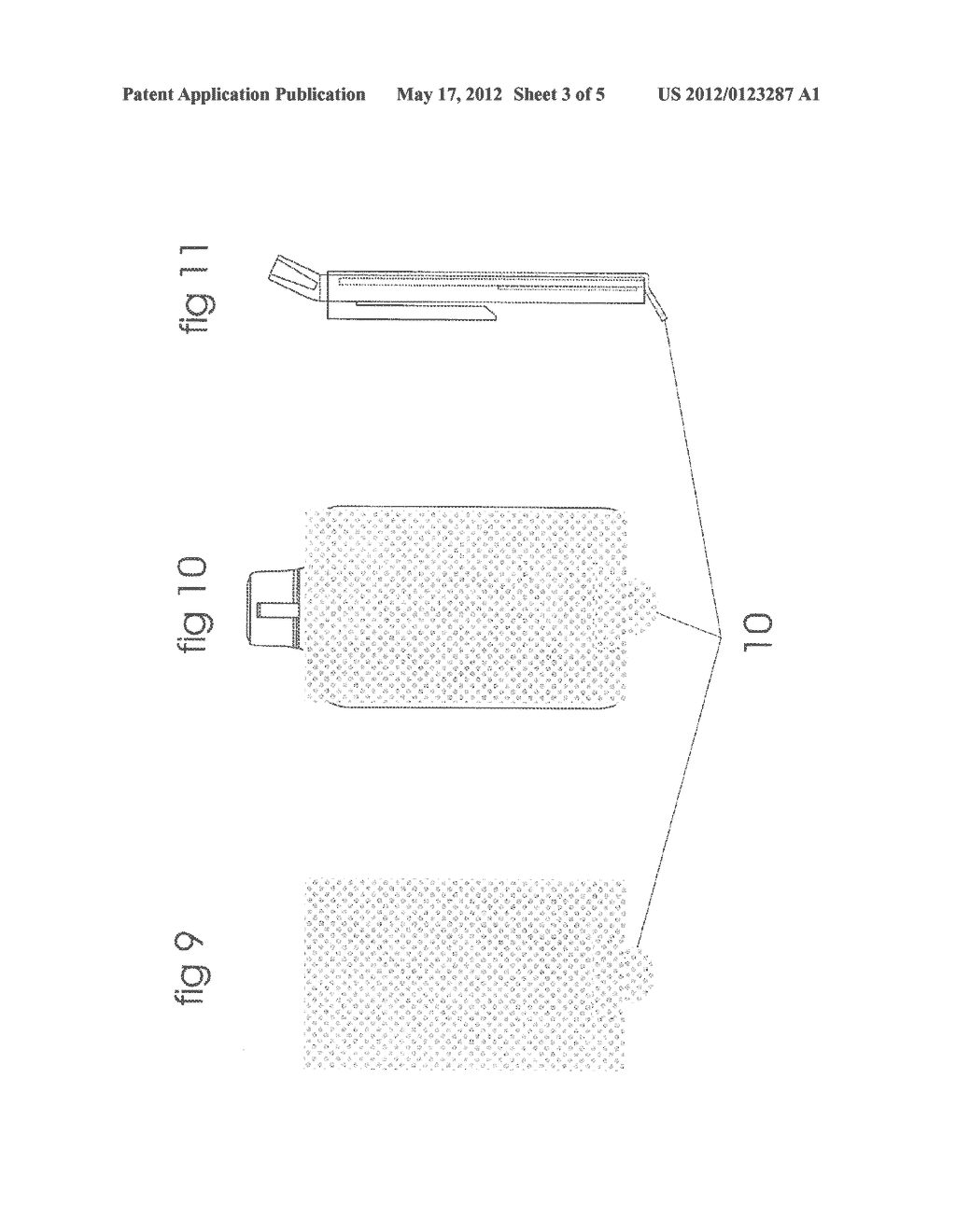 PORTABLE DEVICE FOR BREATHING DETECTION - diagram, schematic, and image 04