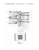 Spinal motion measurement device diagram and image