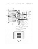 Spinal motion measurement device diagram and image