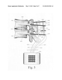 Spinal motion measurement device diagram and image