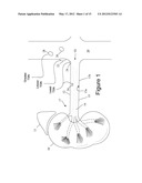 Minimally Invasive Access for Renal Nerve Ablation diagram and image