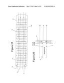 Minimally Invasive Access for Renal Nerve Ablation diagram and image