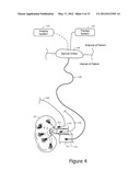 Minimally Invasive Access for Renal Nerve Ablation diagram and image