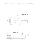 Minimally Invasive Access for Renal Nerve Ablation diagram and image