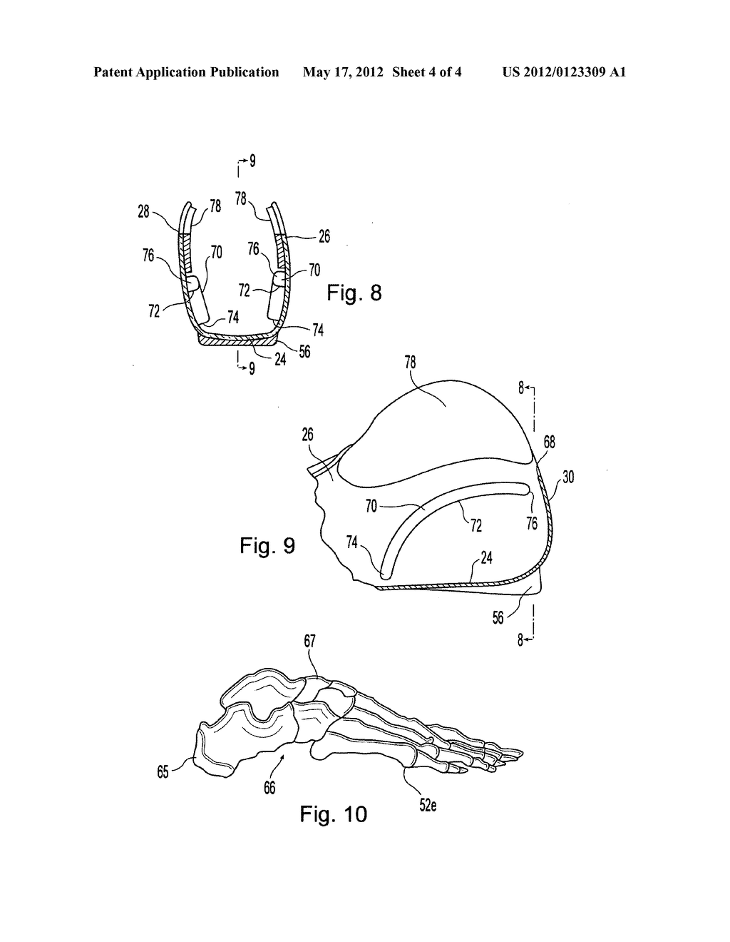 Orthotic device and method of manufacture - diagram, schematic, and image 05