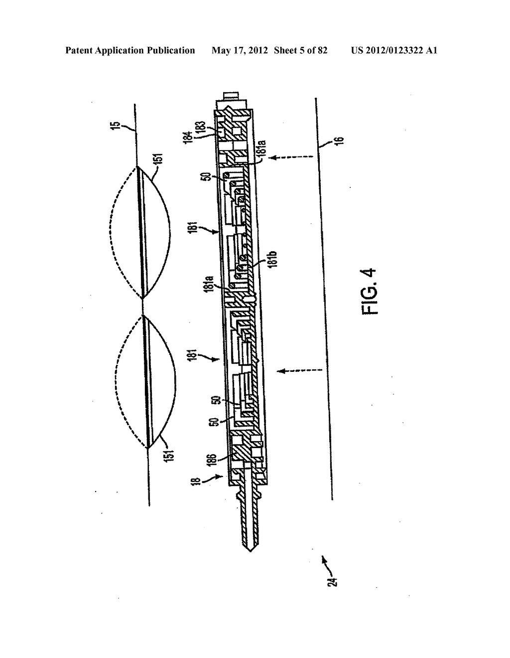 MEDICAL TREATMENT SYSTEM AND METHODS USING A PLURALITY OF FLUID LINES - diagram, schematic, and image 06