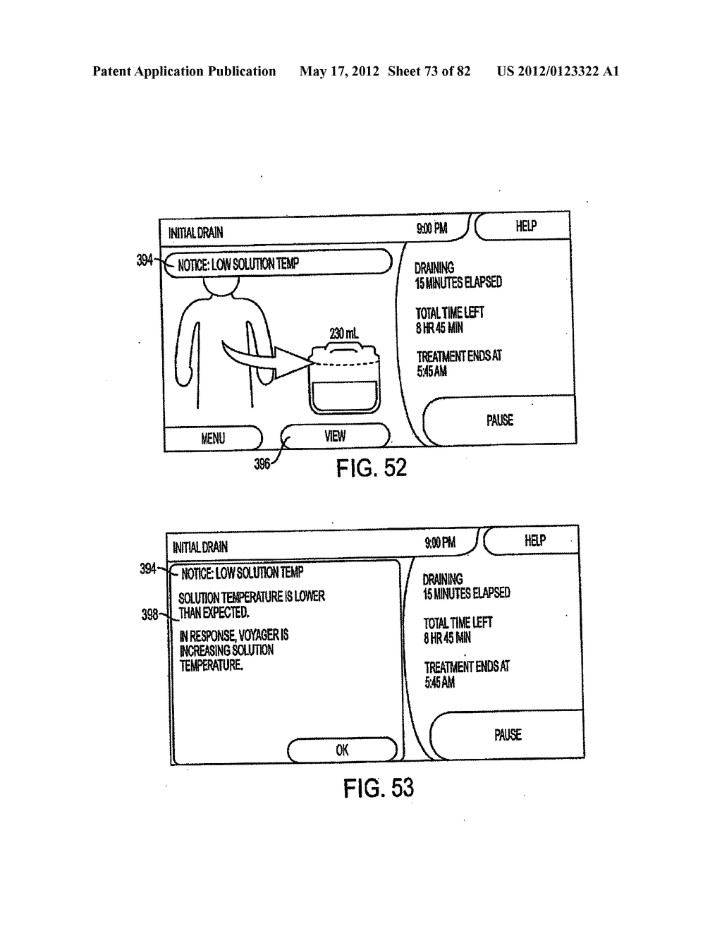 MEDICAL TREATMENT SYSTEM AND METHODS USING A PLURALITY OF FLUID LINES - diagram, schematic, and image 74
