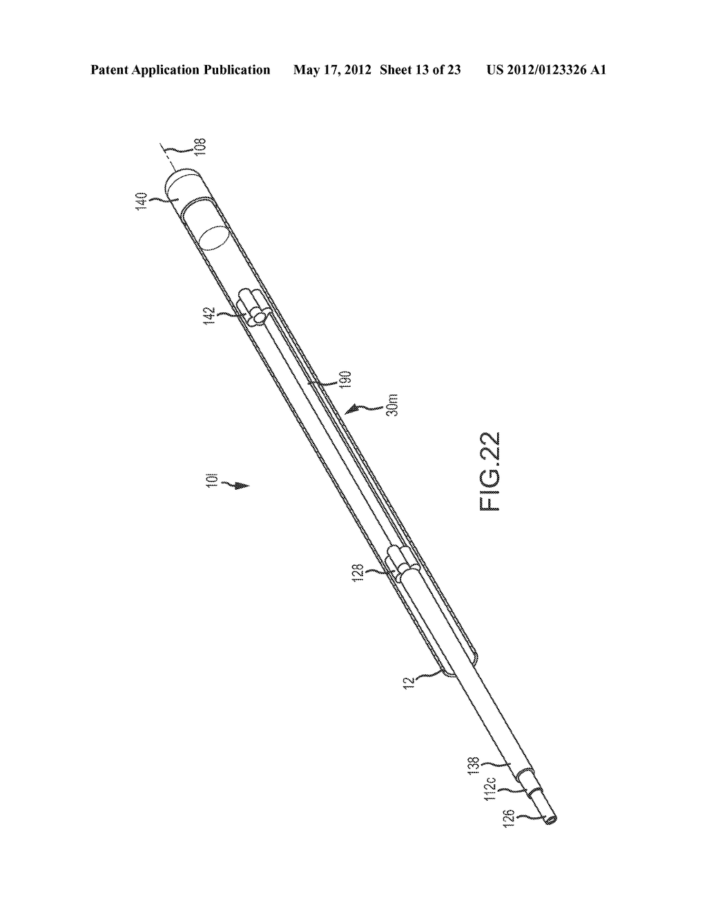 CATHETER SYSTEMS WITH DISTAL END FUNCTION, SUCH AS DISTAL DEFLECTION,     USING REMOTE ACTUATION OR LOW INPUT FORCE - diagram, schematic, and image 14