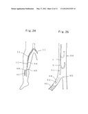  MEDICAL GUIDE WIRE, AN ASSEMBLY OF MICROCATHETER AND GUIDING CATHETER     COMBINED WITH THE MEDICAL GUIDE WIRE, AND AN ASSEMBLY OF BALLOONCATHETER     AND GUIDING CATHETER COMBINED WITH THE MEDICAL GUIDE WIRE diagram and image