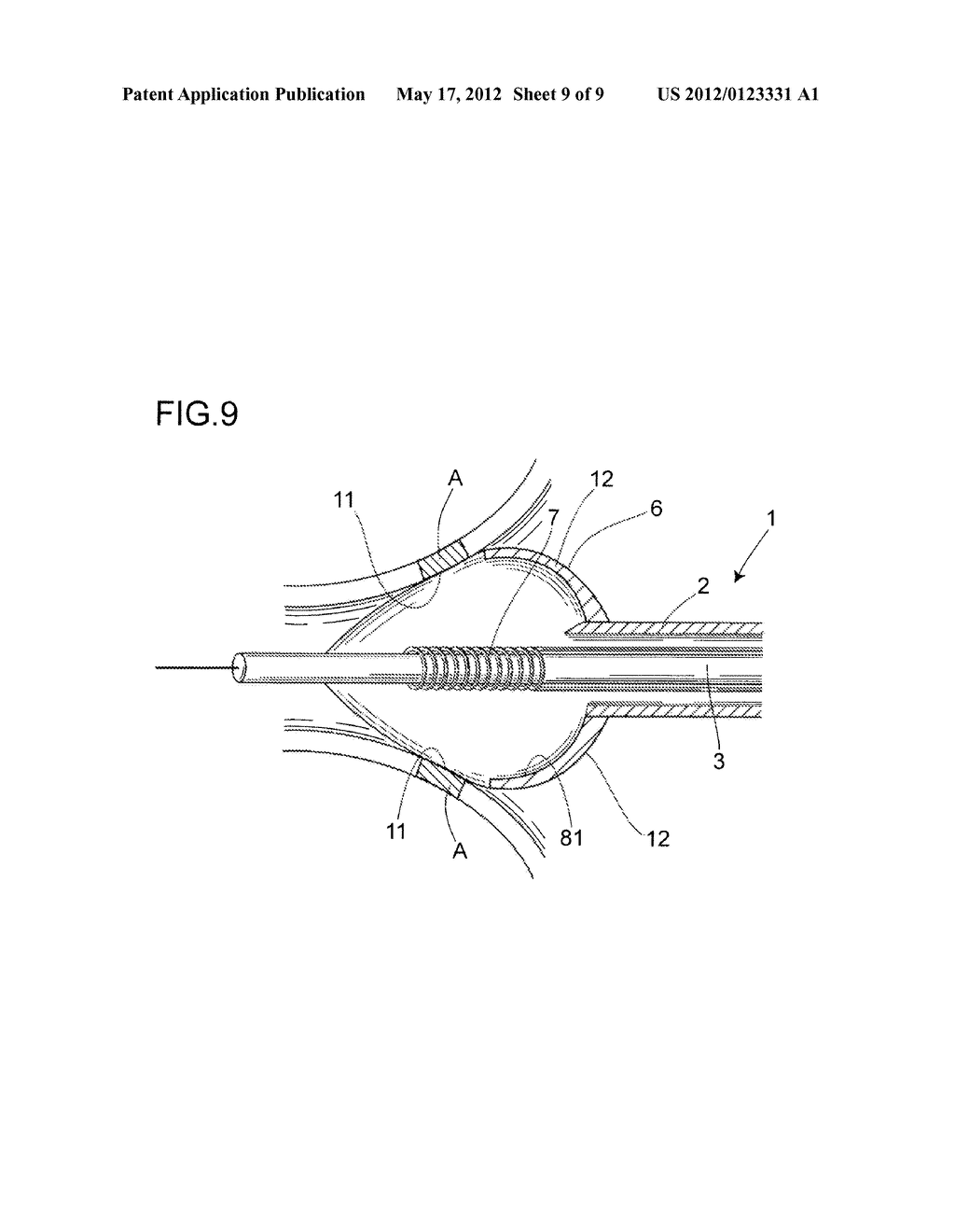 BALLOON CATHETER SYSTEM - diagram, schematic, and image 10