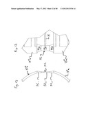 PEN NEEDLE WITH QUICK RELEASE AND/OR REMOVAL SYSTEM diagram and image