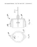 PEN NEEDLE WITH QUICK RELEASE AND/OR REMOVAL SYSTEM diagram and image