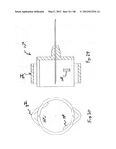 PEN NEEDLE WITH QUICK RELEASE AND/OR REMOVAL SYSTEM diagram and image