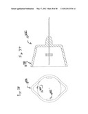 PEN NEEDLE WITH QUICK RELEASE AND/OR REMOVAL SYSTEM diagram and image