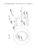 PEN NEEDLE WITH QUICK RELEASE AND/OR REMOVAL SYSTEM diagram and image