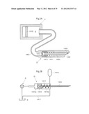 IMPLANTABLE LUBRICATION DEVICE AND METHOD OF TREATING A HUMAN OR MAMMAL     PATIENT BY MEANS OF THE DEVICE diagram and image