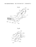 IMPLANTABLE LUBRICATION DEVICE AND METHOD OF TREATING A HUMAN OR MAMMAL     PATIENT BY MEANS OF THE DEVICE diagram and image