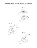 IMPLANTABLE LUBRICATION DEVICE AND METHOD OF TREATING A HUMAN OR MAMMAL     PATIENT BY MEANS OF THE DEVICE diagram and image