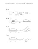 IMPLANTABLE LUBRICATION DEVICE AND METHOD OF TREATING A HUMAN OR MAMMAL     PATIENT BY MEANS OF THE DEVICE diagram and image