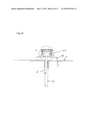 PORT NEEDLE HAVING NEEDLE-PRICK PROTECTION DEVICE diagram and image