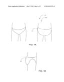 FREEDOM-DISPOSABLE UNDERWEAR SYSTEMS FOR WOMEN AND INCONTINENT INDIVIDUALS diagram and image