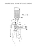 SAFETY DRUG HANDLING DEVICE diagram and image