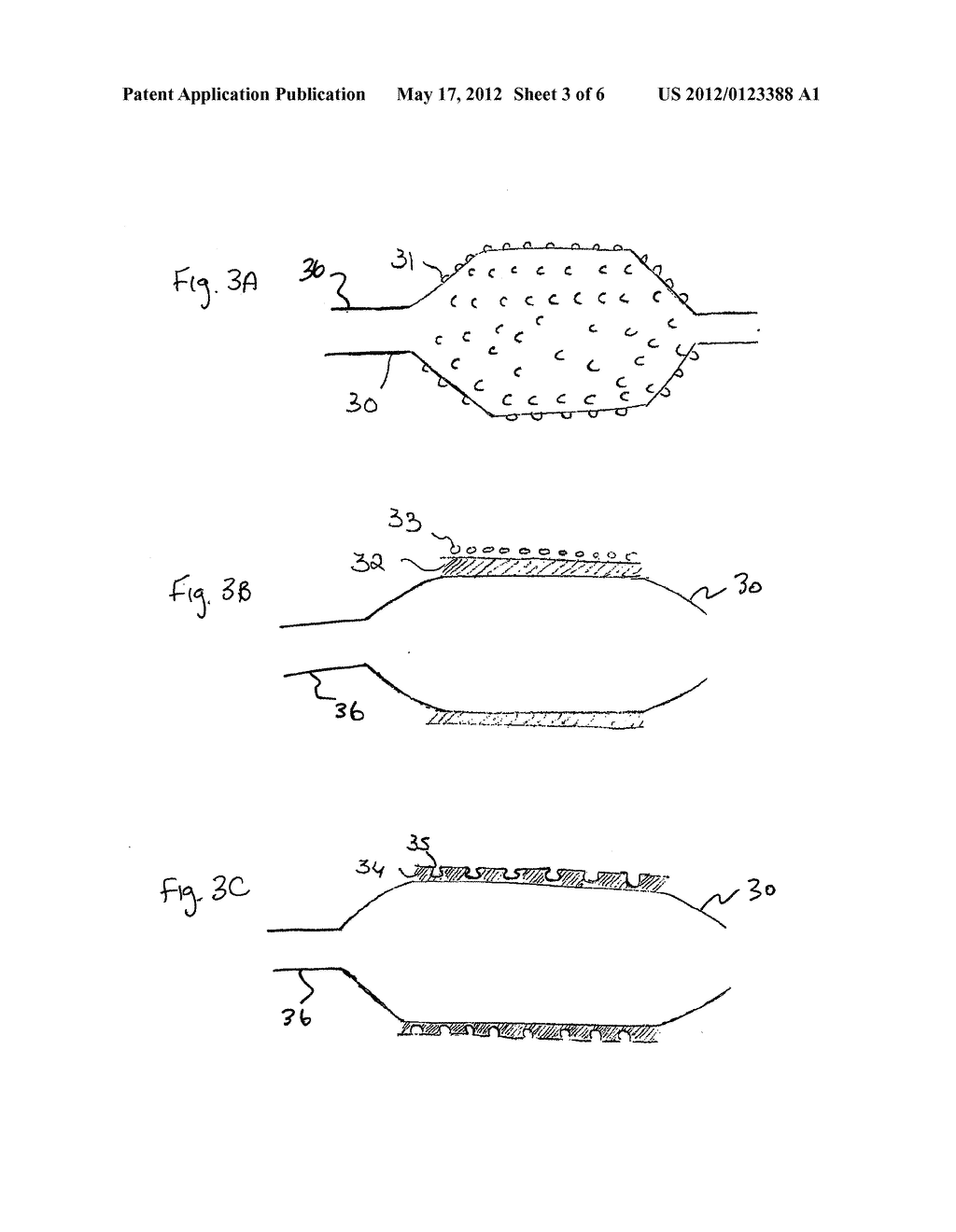 METHOD AND APPARATUS FOR TRANSPORT OF SUBSTANCES INTO BODY TISSUE - diagram, schematic, and image 04