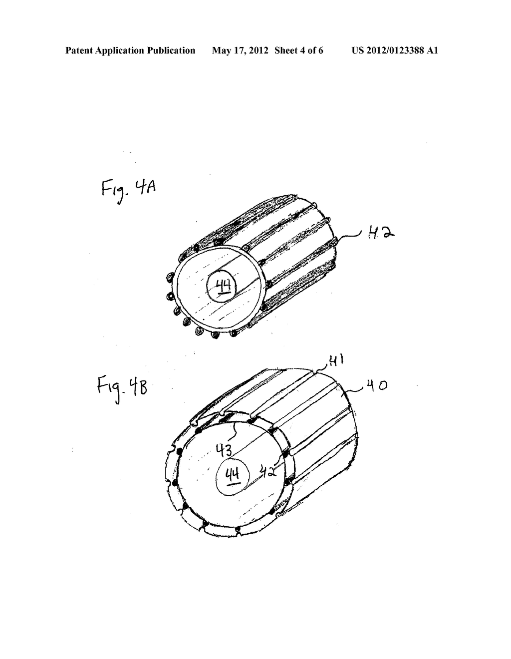 METHOD AND APPARATUS FOR TRANSPORT OF SUBSTANCES INTO BODY TISSUE - diagram, schematic, and image 05