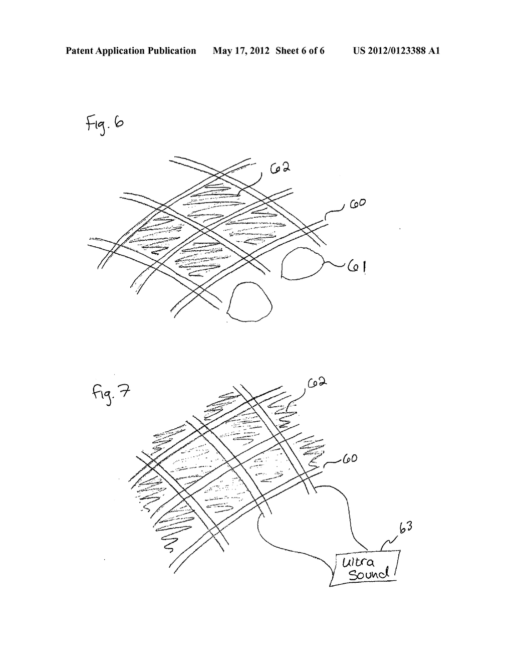 METHOD AND APPARATUS FOR TRANSPORT OF SUBSTANCES INTO BODY TISSUE - diagram, schematic, and image 07
