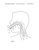 Medical Apparatus With Hypopharyngeal Suctioning Capability diagram and image