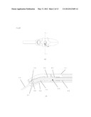 MEDICAL TREATMENT DEVICE diagram and image